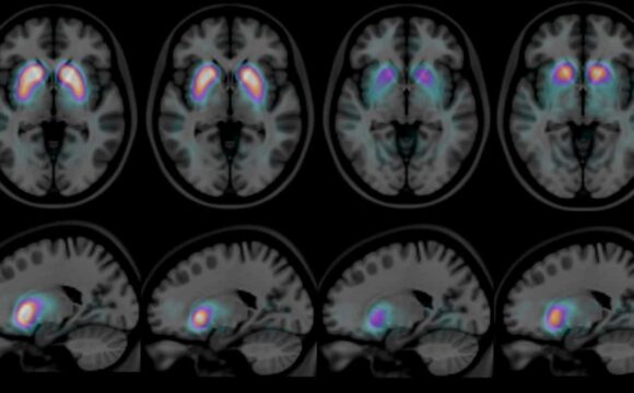 Häufige Fragen zur Demenz